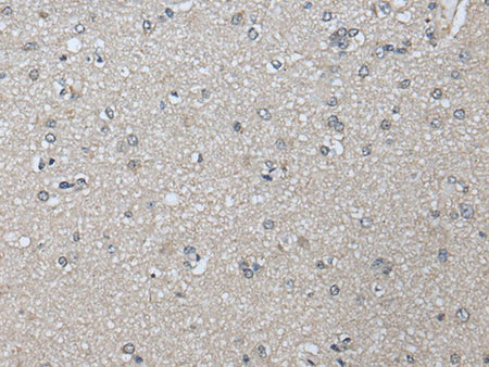 PRAME Polyclonal Antibody