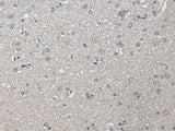 PRAME Polyclonal Antibody