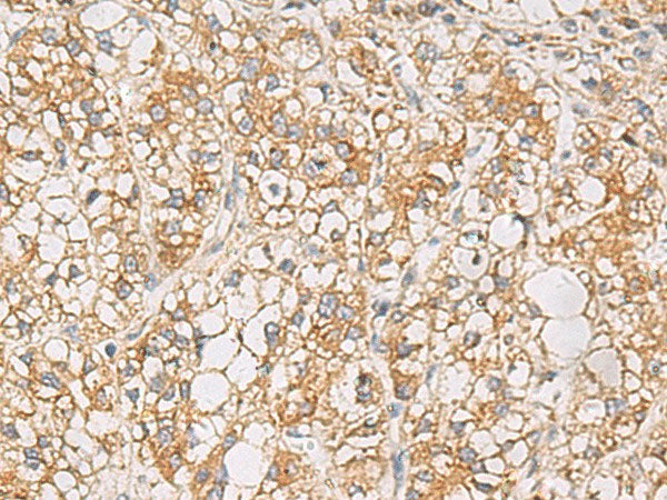 PTPRN Polyclonal Antibody Reactivity Human