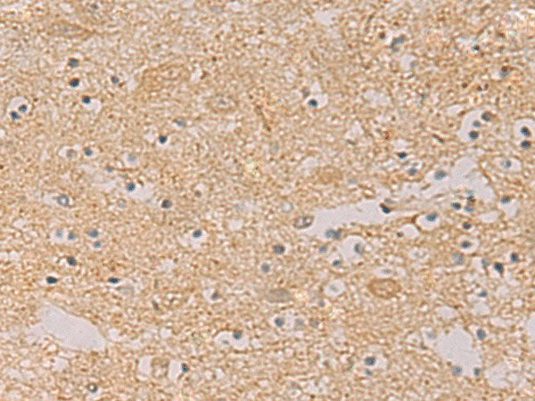 PTPRN Polyclonal Antibody Reactivity Human