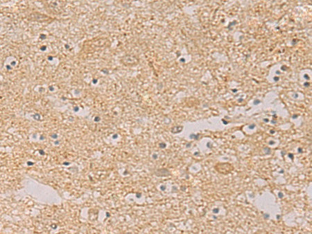 PTPRN Polyclonal Antibody Reactivity Human