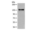 PTPRA Polyclonal Antibody Reactivity Human