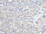 RASA1 Polyclonal Antibody Reactivity Human