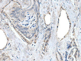 RASSF8 Polyclonal Antibody