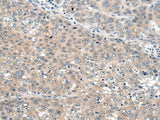 SEMA4D Polyclonal Antibody Reactivity Mouse