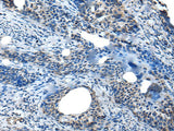 SAA4 Polyclonal Antibody