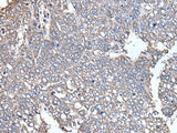SCP2 Polyclonal Antibody Reactivity Mouse