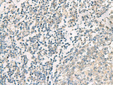 SERPINB4 Polyclonal Antibody Reactivity Human