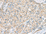 SHC3 Polyclonal Antibody