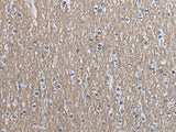 SLC39A14 Polyclonal Antibody