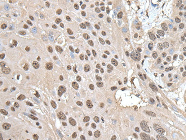 SMC1A Polyclonal Antibody Reactivity Mouse