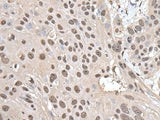SMC1A Polyclonal Antibody Reactivity Mouse