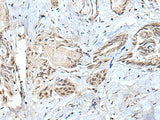 SMC1A Polyclonal Antibody Reactivity Mouse