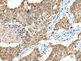 SPRY4 Polyclonal Antibody Reactivity Human