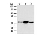 SPRY4 Polyclonal Antibody Reactivity Human