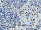 TPT1 Polyclonal Antibody Reactivity Human