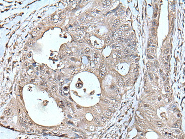 TPT1 Polyclonal Antibody Reactivity Human