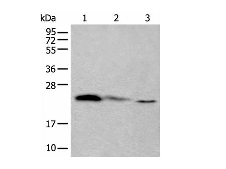 TPT1 Polyclonal Antibody Reactivity Human
