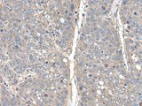 THAP10 Polyclonal Antibody