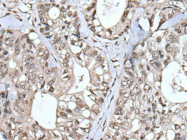 TIA1 Polyclonal Antibody Reactivity Human