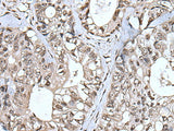 TIA1 Polyclonal Antibody Reactivity Human