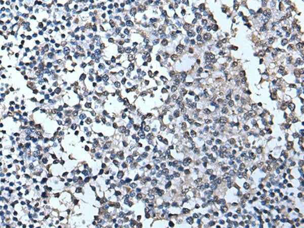 TIA1 Polyclonal Antibody Reactivity Human
