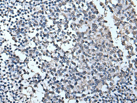TIA1 Polyclonal Antibody Reactivity Human