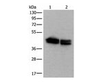 TIA1 Polyclonal Antibody Reactivity Human
