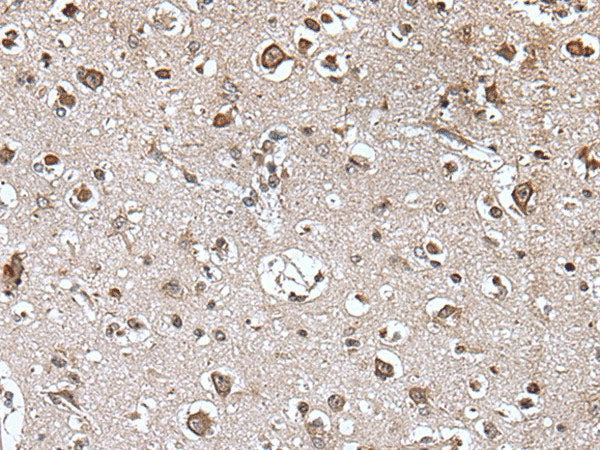 TRIM27 Polyclonal Antibody Reactivity Mouse