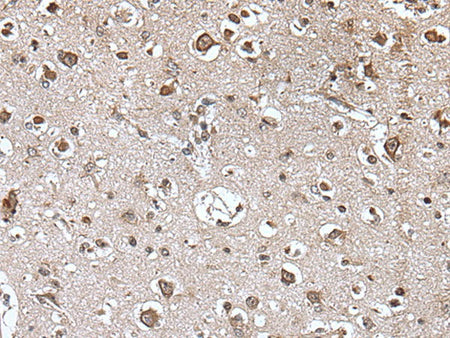 TRIM27 Polyclonal Antibody Reactivity Mouse