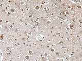 TRIM27 Polyclonal Antibody Reactivity Mouse