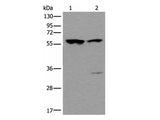 TRIM27 Polyclonal Antibody Reactivity Mouse