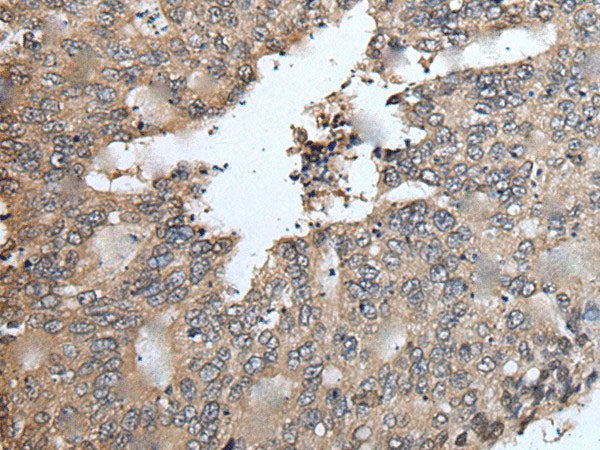TRIM23 Polyclonal Antibody Reactivity Rat