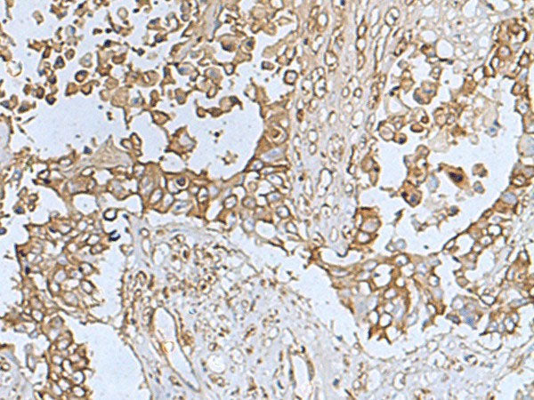 TREM1 Polyclonal Antibody Reactivity Human
