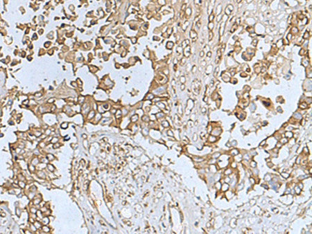 TREM1 Polyclonal Antibody Reactivity Human