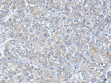 TREM1 Polyclonal Antibody Reactivity Human