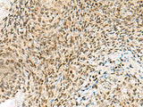 UBLCP1 Polyclonal Antibody Reactivity Human