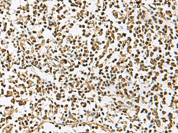 UBLCP1 Polyclonal Antibody Reactivity Human