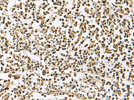 UBLCP1 Polyclonal Antibody Reactivity Human