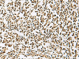 UBLCP1 Polyclonal Antibody Reactivity Human