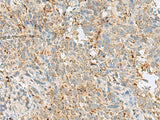 VDAC3 Polyclonal Antibody Reactivity Human
