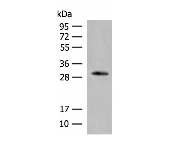 VDAC3 Polyclonal Antibody Reactivity Human