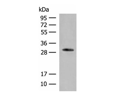 VDAC3 Polyclonal Antibody Reactivity Human