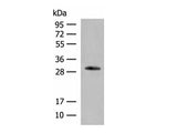 VDAC3 Polyclonal Antibody Reactivity Human