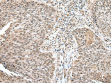 WDR18 Polyclonal Antibody Reactivity Mouse