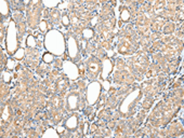 DPH7 Polyclonal Antibody
