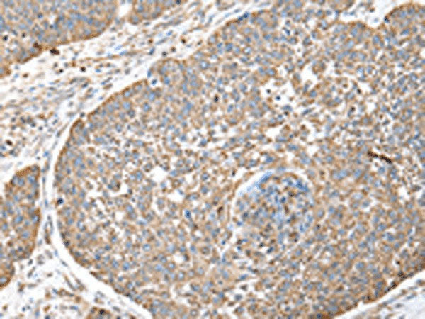 DPH7 Polyclonal Antibody