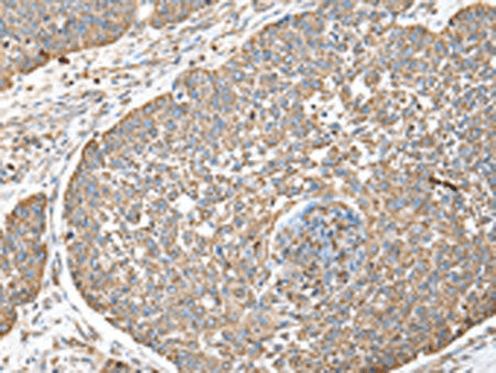 DPH7 Polyclonal Antibody