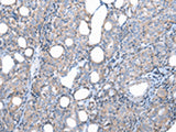 FKBPL Polyclonal Antibody