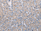 FKBPL Polyclonal Antibody